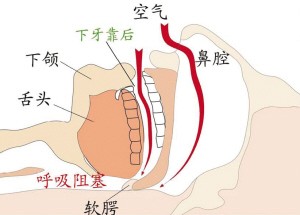 �������ʲôԭ��