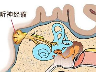 ����ţ����������Ԥ��