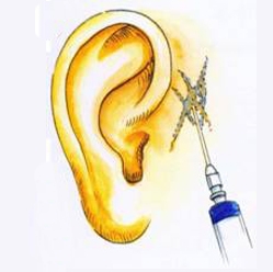 ��ͳ�Ʒ�������ƶ���