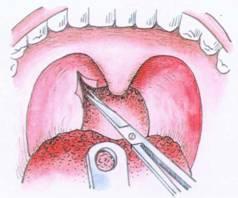 ����������ԭ������Щ