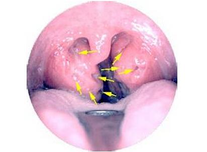 ���¶�ͯ�����Ķ���ԭ��